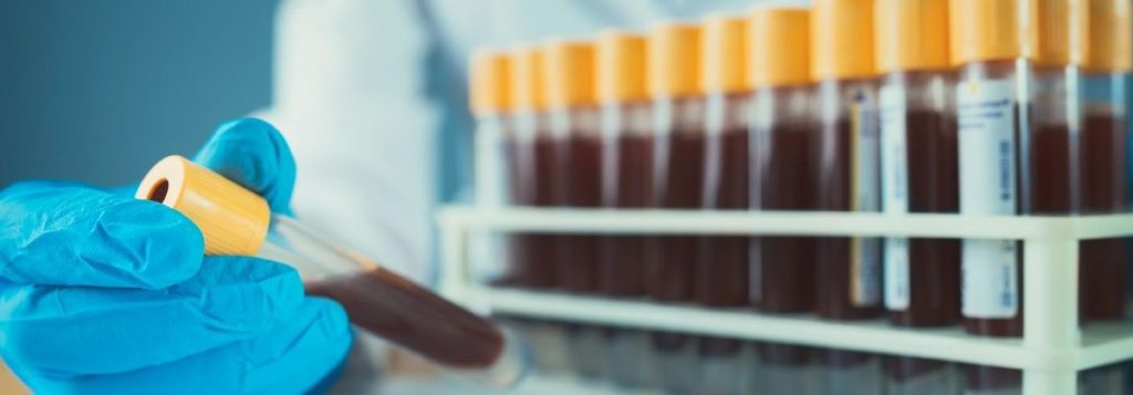 Mögliche Krankheitsanfälligkeiten je nach Blutgruppe ➤ Globenow.info