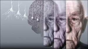 La demencia se puede detectar de forma temprana: una señal específica puede indicar quién está particularmente en riesgo.