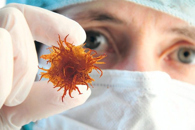 Cuatro alimentos que, según los expertos en cáncer, se deben evitar ➤ Globenow.info