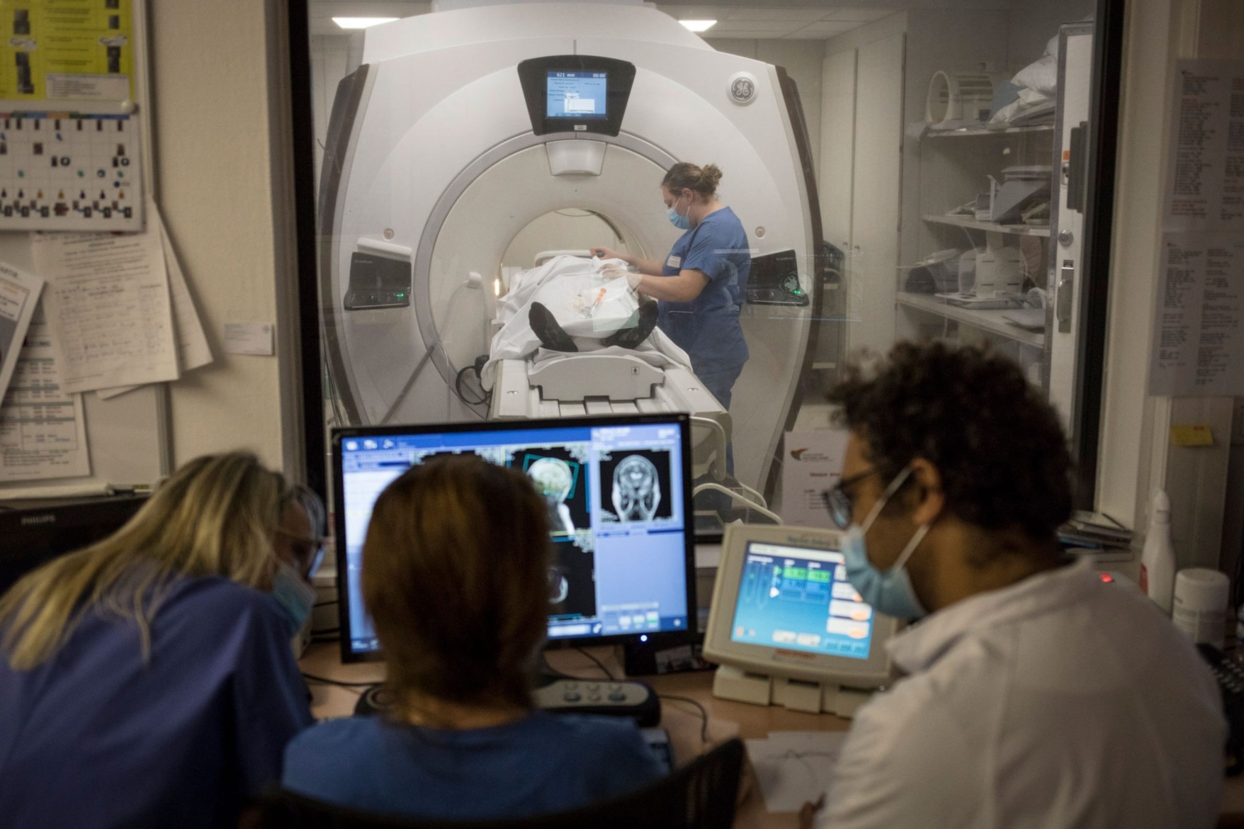 Cientistas soam o alarme: O que acontece com o cérebro após a COVID-19?