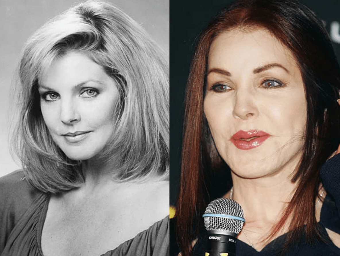 Prominente, deren Schönheitsoperationen für Aufsehen sorgten: Was Experten sagen